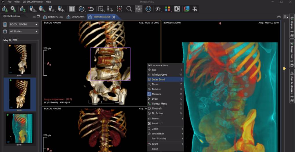 Weasis Medical DICOM viewer